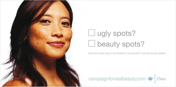 beauty-spots